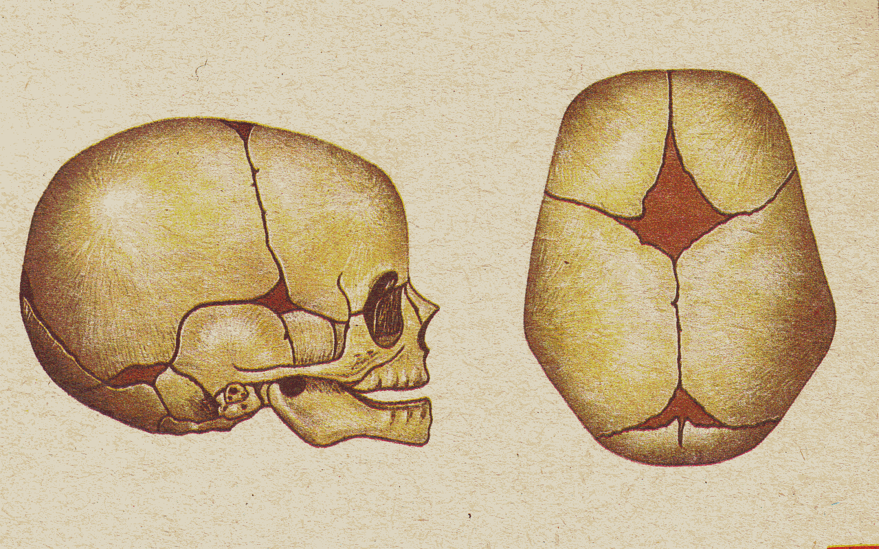 Шов между теменными костями. Кости черепа новорожденного роднички. Роднички новорожденного анатомия черепа. Строение черепа новорожденного швы роднички. Роднички черепа у новорожденных анатомия.